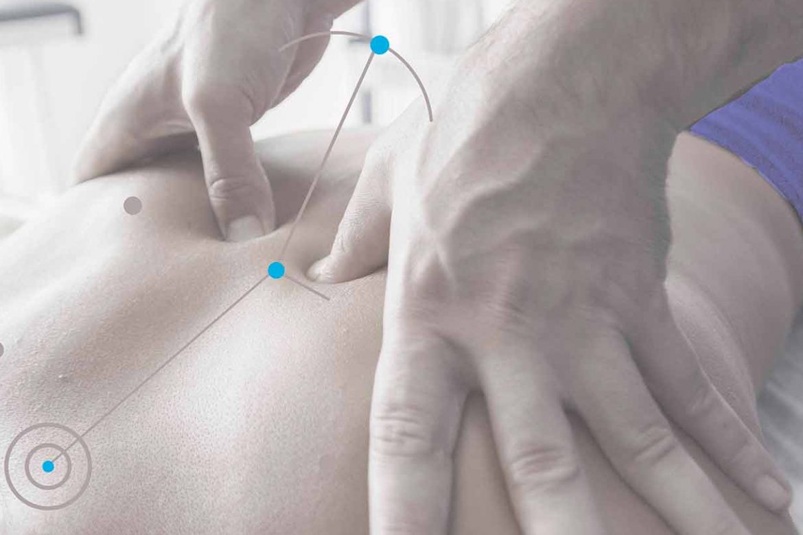 Mitos de la fisioterapia